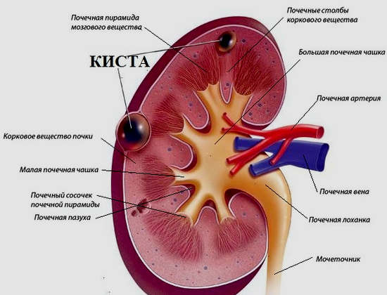 Какие симптомы говорят о кисте в почке? Кто в группе риска? - раскрывает секрет магазин медтехники ME-D.RU